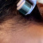 Scalp and Beard Microneedling Roller