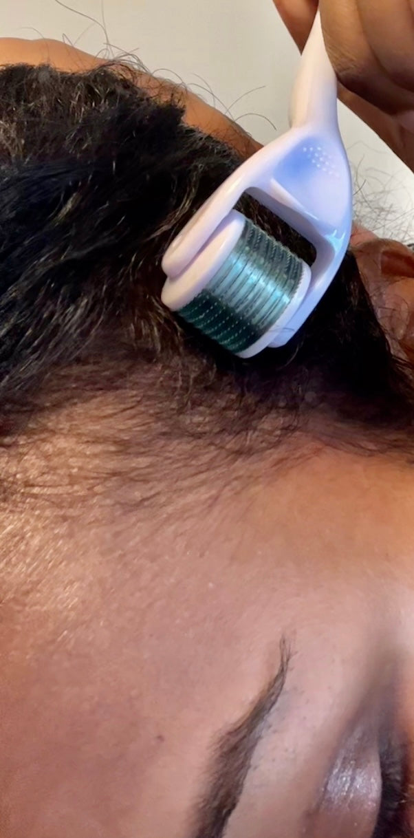 Scalp and Beard Microneedling Roller